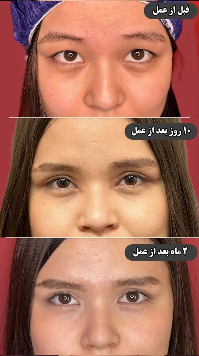 belfaro-mohamadkhani-034