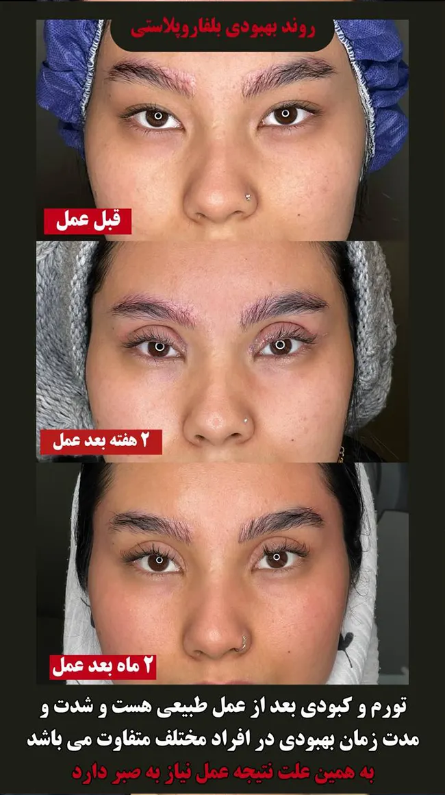 belfaro-mohamadkhani-035