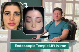 Endoscopic Temple Lift in Iran